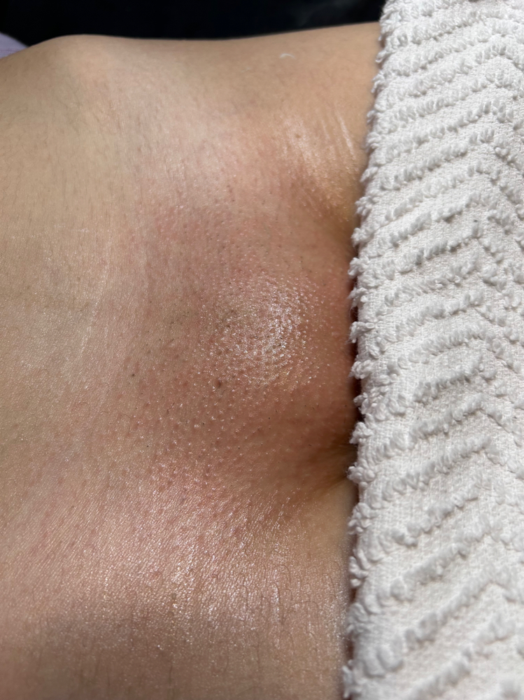Brazilian waxing in Goodyear AZ at Amor Esthetics, esthetician near me